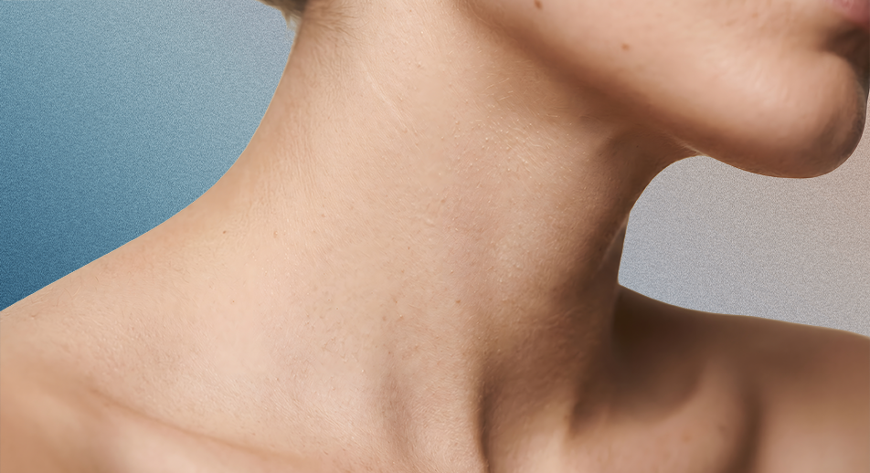 Nefertiti Lift, redefinición de cuello y mandíbula-face360